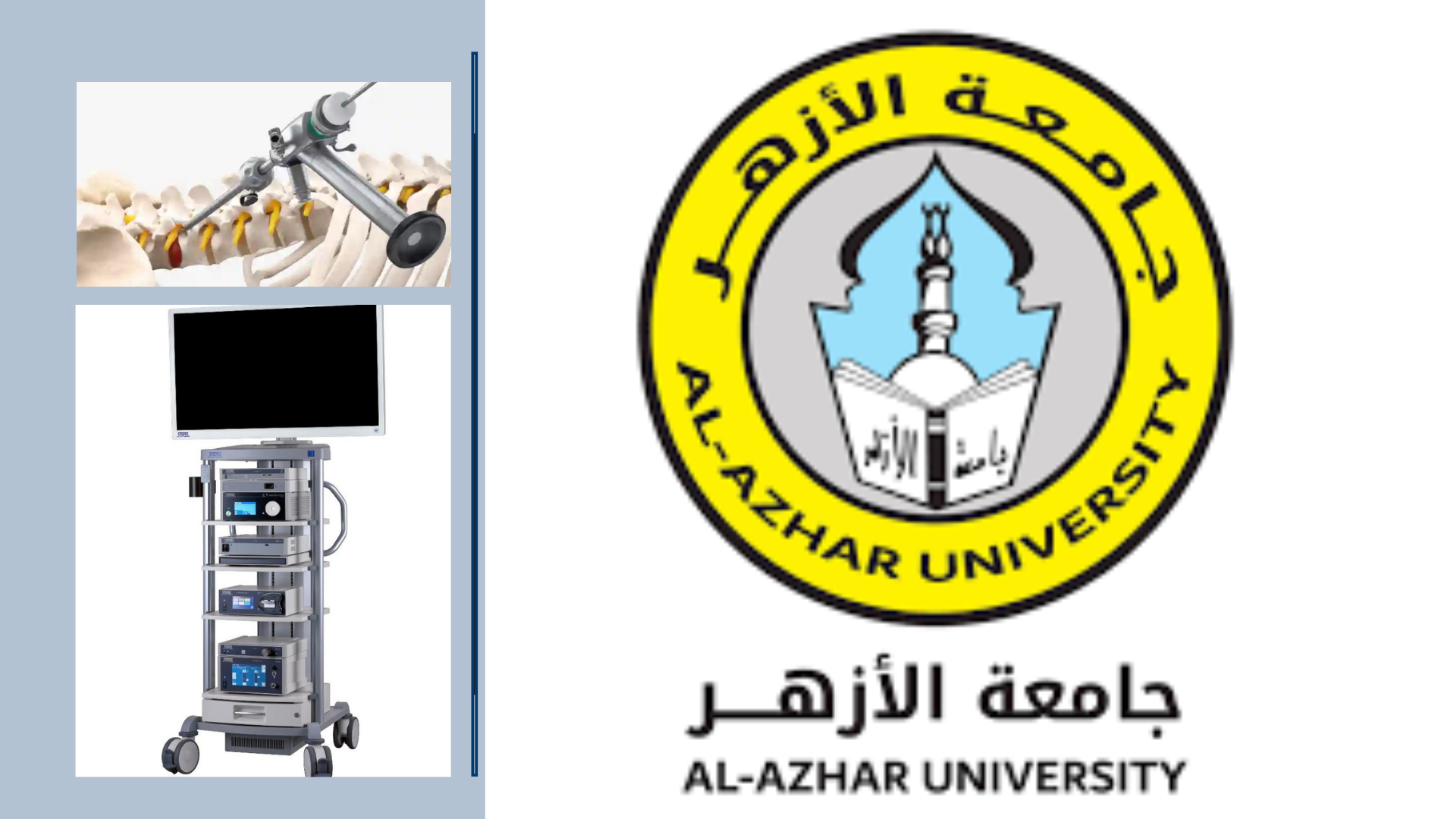 MOPCO contributes to the development of the Neurosurgery Department at Al-Azhar University Hospital in Damietta Governorate